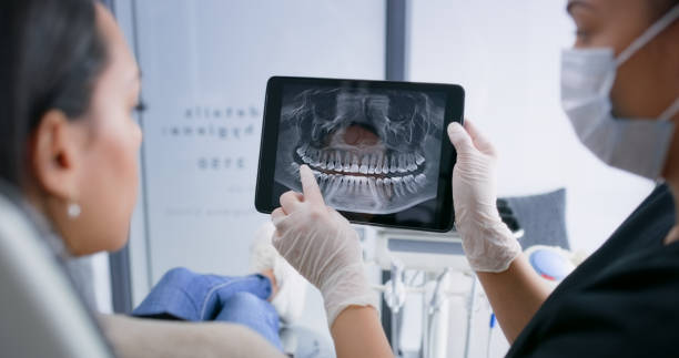 Licensed Tooth Extraction service in Burlington, VT - Smile Center Dentistry